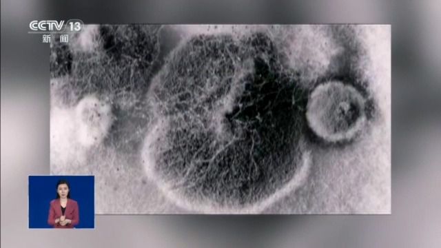 女孩脑部被真菌侵蚀出现“空洞”？大扫除要警惕霉变粉尘！