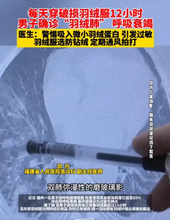 男子穿破损羽绒服致“羽绒肺”！医生详解