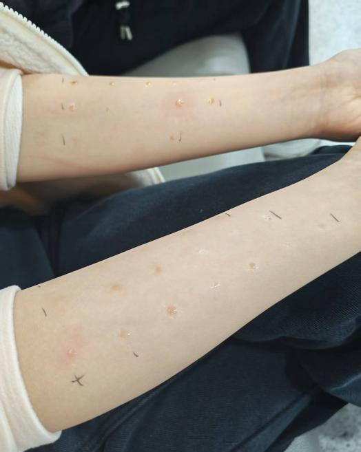 中新健康｜花粉过敏为何越来越普遍？