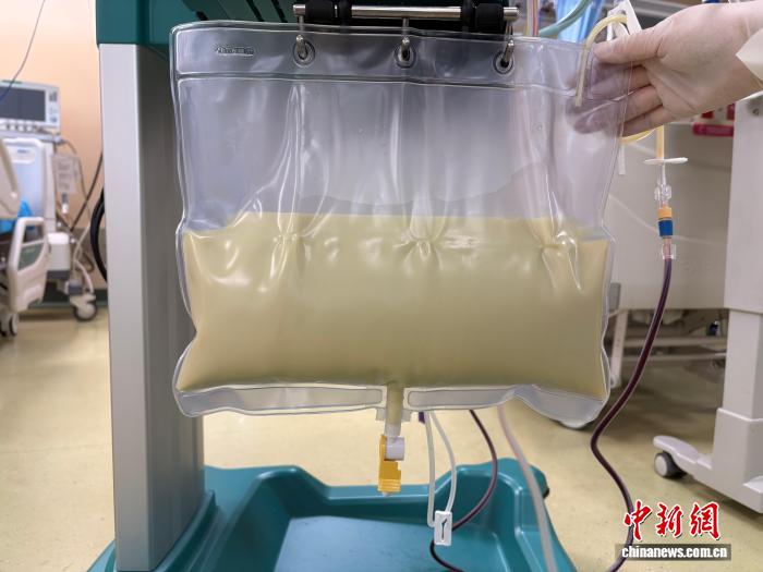 湖南双胎孕妇“牛奶血”诱发多重危情 多学科联手救治