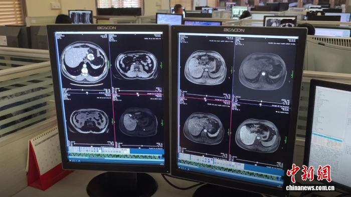 中国首个“AI+影像识别”专业赛事撬动医疗影像变革