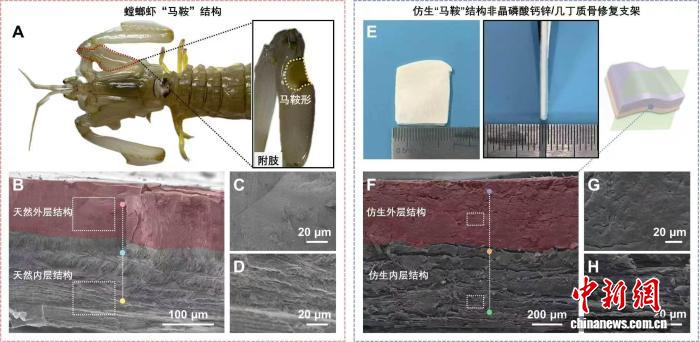 中国生物活性骨修复材料获系列突破 三项创新成果助力骨病治疗