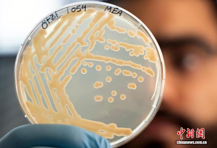 国际最新研究：5300岁“冰人奥茨”微生物组或具代谢活性